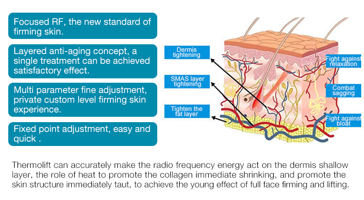 Project E Rf Machine