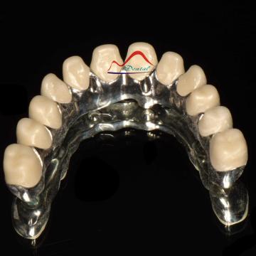 Zirconia Implant Malo Bridge