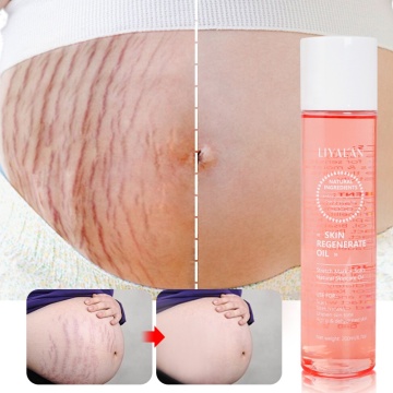Private Label Body Care Anti Stretch Peeling Oil for Scar and Stretch Mark Removal
