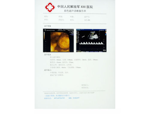 20cm * 25cm High Sharpness Medical Imaging Paper Laser Printer Film For Knd-drytec-3000
