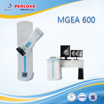 X ray machine digitalized mammography screening system MEGA600