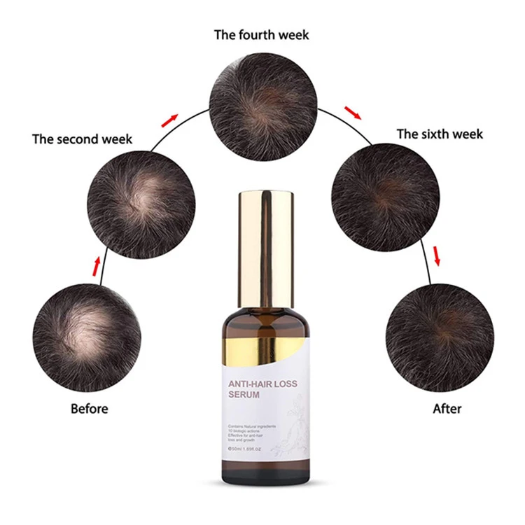 Custom Private Label Hair Grow Serum for Thinning Anti Hair Loss Treatment