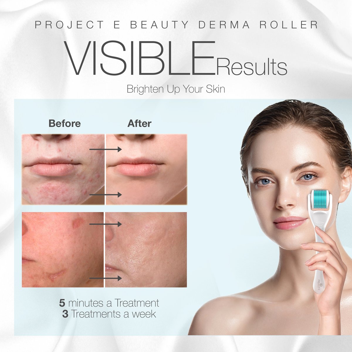 6in1derma roller 6in1derma roller