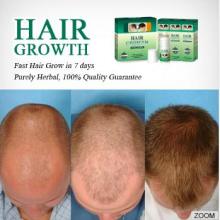 World Top Effective YUDA Anti Hair Loss Cream for Men