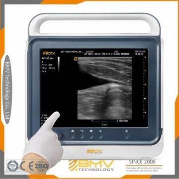 PT50A Home Medical Equipment Ultrasound Imaging