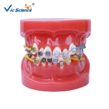 Ortho Metal  Ceramic