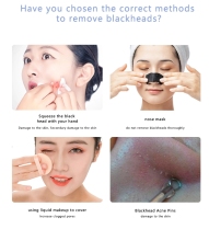 Blackhead Remover Tool 1