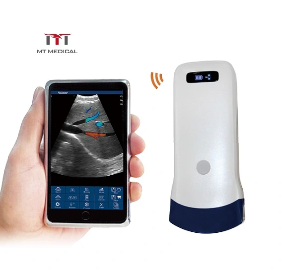 128 Elements Wireless Ultrasound Color Doppler Micro Convex Probe for Android&Ios&Windows