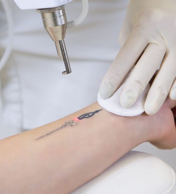 Choicy Academy Tattoo Removal Removal Tender Online