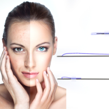 Suture Sharp 21g 60mm PDO Thread