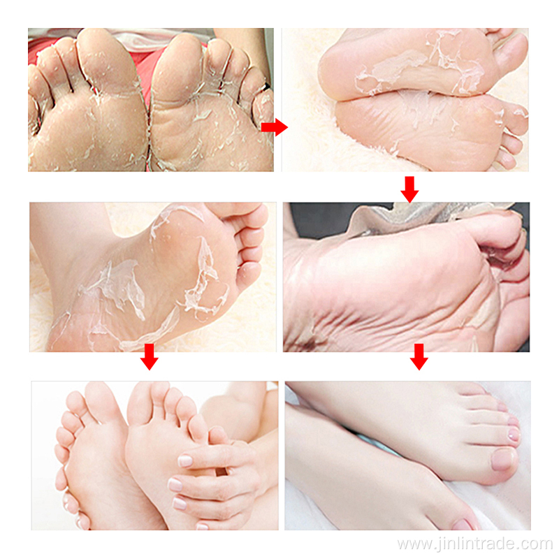 Foot Mask Peeling Exfoliating Milk Organic Foot Mask