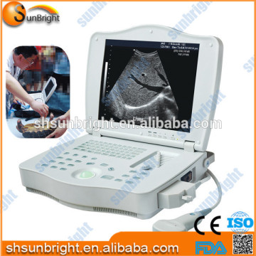 Veterinary ultrasound/Digital laptop ultrasound scanner