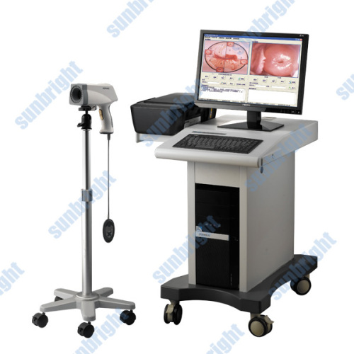 Colposcope image system