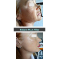 Natural Beauty Skin Care Wrinkle Removal Filler For Face