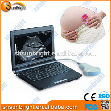 Competitive price mini laptop ultrasound machine with high quality