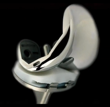 Artificial Adjustable Knee Replacement System