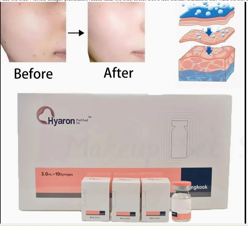 ハイアロン hyaron