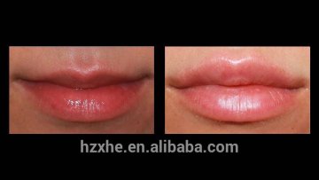Lip Enhancer Sodium Hyaluronic Gel