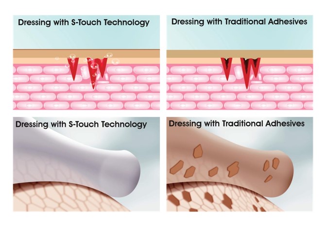 Silicone Foam Dressing