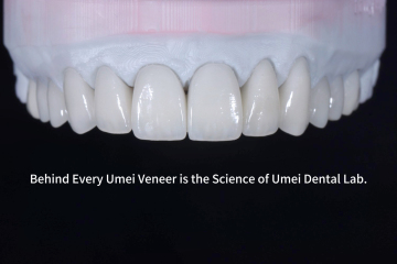 Ultra-thin aesthetic restorative veneers