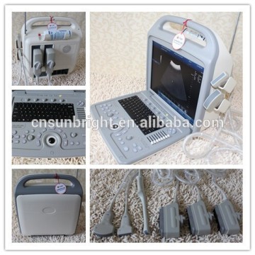 Portable Color Doppler Ultrasound/ 3D doppler ultrasound