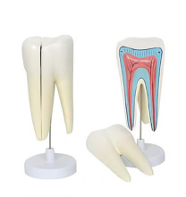 The molar structure model