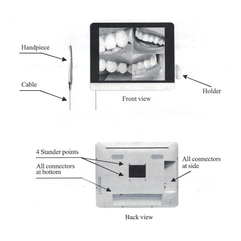 endoscope