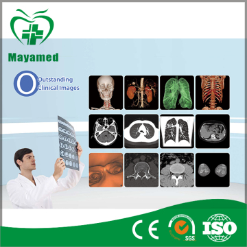 Medical x ray for hospital,x ray image digitizer,x-ray CT scanner