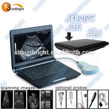 Movable ultrasound scanner&price laptop ultrasound&portable ultrasound scanner