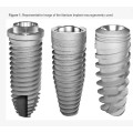 Implanted titanium alloy screw for surgical and dental