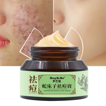 Repair Acne Cream Anti Spots Facial Cream
