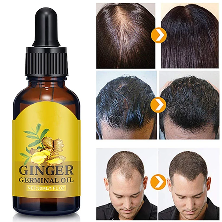 Wholesale Ginger Hair Growth Oil Hair Growth Repair Treatment Oil