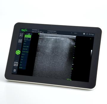 Fast Scan OPU big back fat