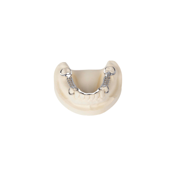 Dental Cast Partial Framework