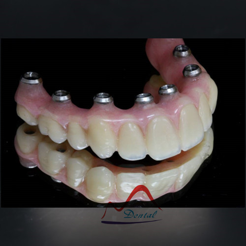 Hot sale Dental hybrid denture