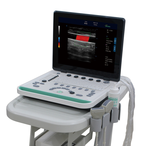 Color Doppler Ultrasound Machine
