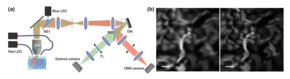  Conjugated AO wide-field microscope system and imaging comparison before and after AO correction