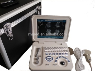 Portable Ultrasonic machine, echo ultrasound scanner, ultrasonic scanner