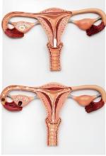 The egg fertilization process amplifies the model