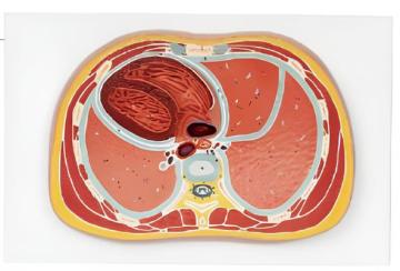 Thoracic transection