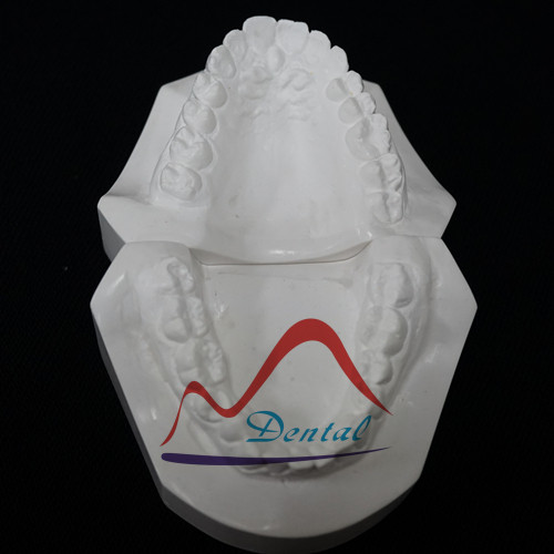 Orthodontic models upper and lower