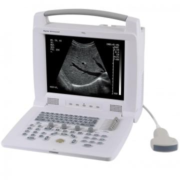 Portable Laptop Ultrasound Scanner Ultrasound Machine Price