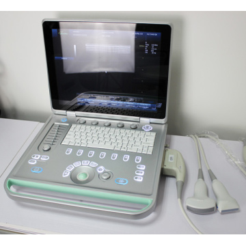 Machine à ultrasons portable portable pour la clinique