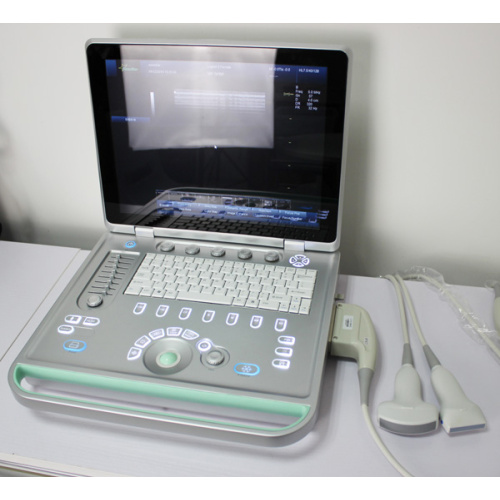 Máquina portátil de ultrasonido portátil para la clínica