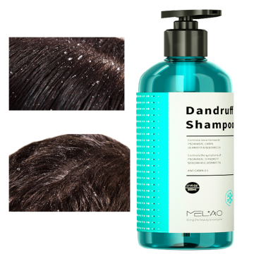 Nourishing Deep Cleansing Anti Dandruff Hair Shampoo