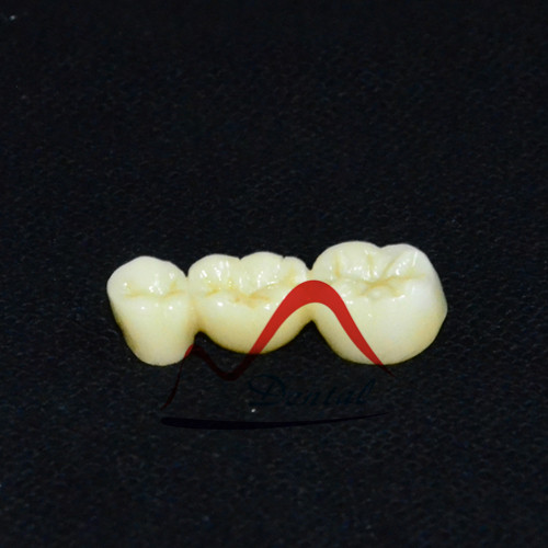 Dental full zirconia splinted crowns