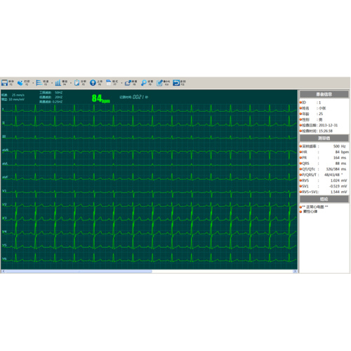 Máquina ECG de 12 canales electrocardiógrafo