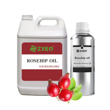 Hair-Loss Prevention Hair Growth Rosehip Wholesale Rosehip Strengthening Hair Oil