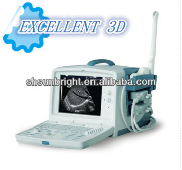 three dimension ultrasound scanner