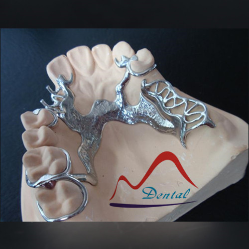 Vitallium framework  (5)